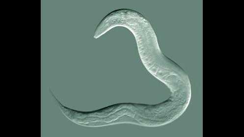 <p>picture of worm Caenorhabditis Elegans taken by Bob Goldstein, UNC Chapel Hill http://bio.unc.edu/people/faculty/goldstein/  available on wikipedia</p>