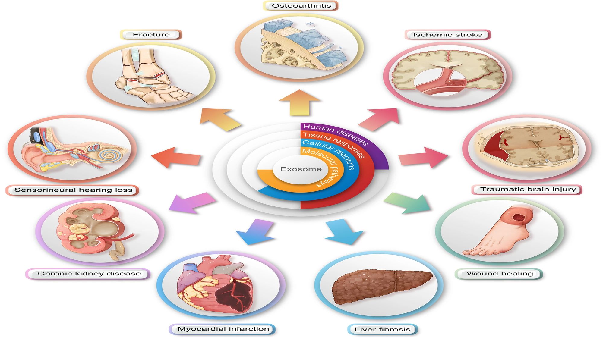 <p>Illustration of the downstream surgical applications of exosome therapy</p>