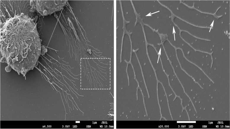 <p>Migrasomes from RAW264.7 cells. Transmission electron microscopy image of migrasomes after 24 h of cell culture (the left side), Scale bar = 1 μm. The larger magnification image of the white box in the left (the right side), Scale bar = 1 μm. The white arrows indicate the migrasomes</p>